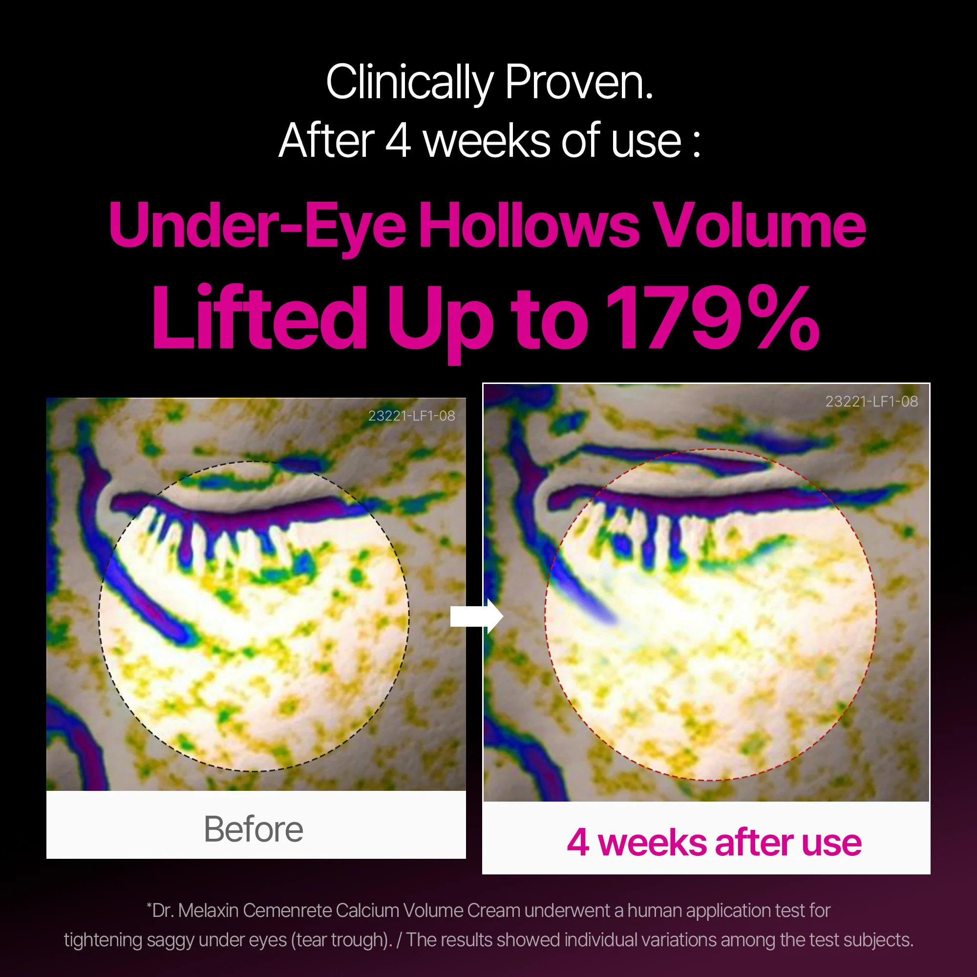 cemenrete calcium eyecare routine cemenrete calcium eyecare routine