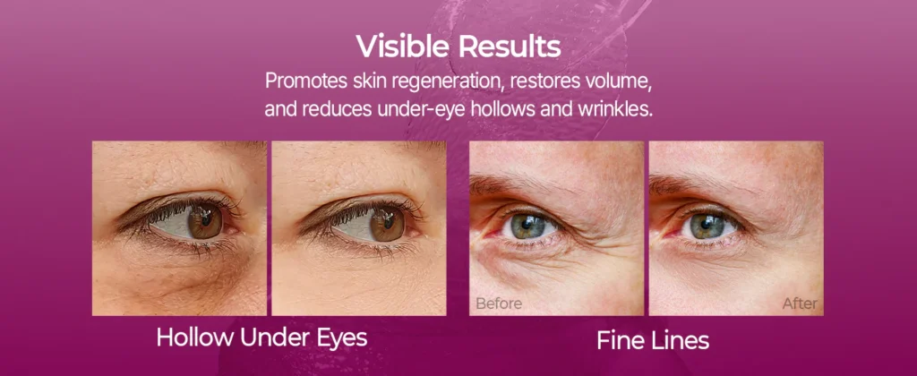 水泥钙眼部护理流程